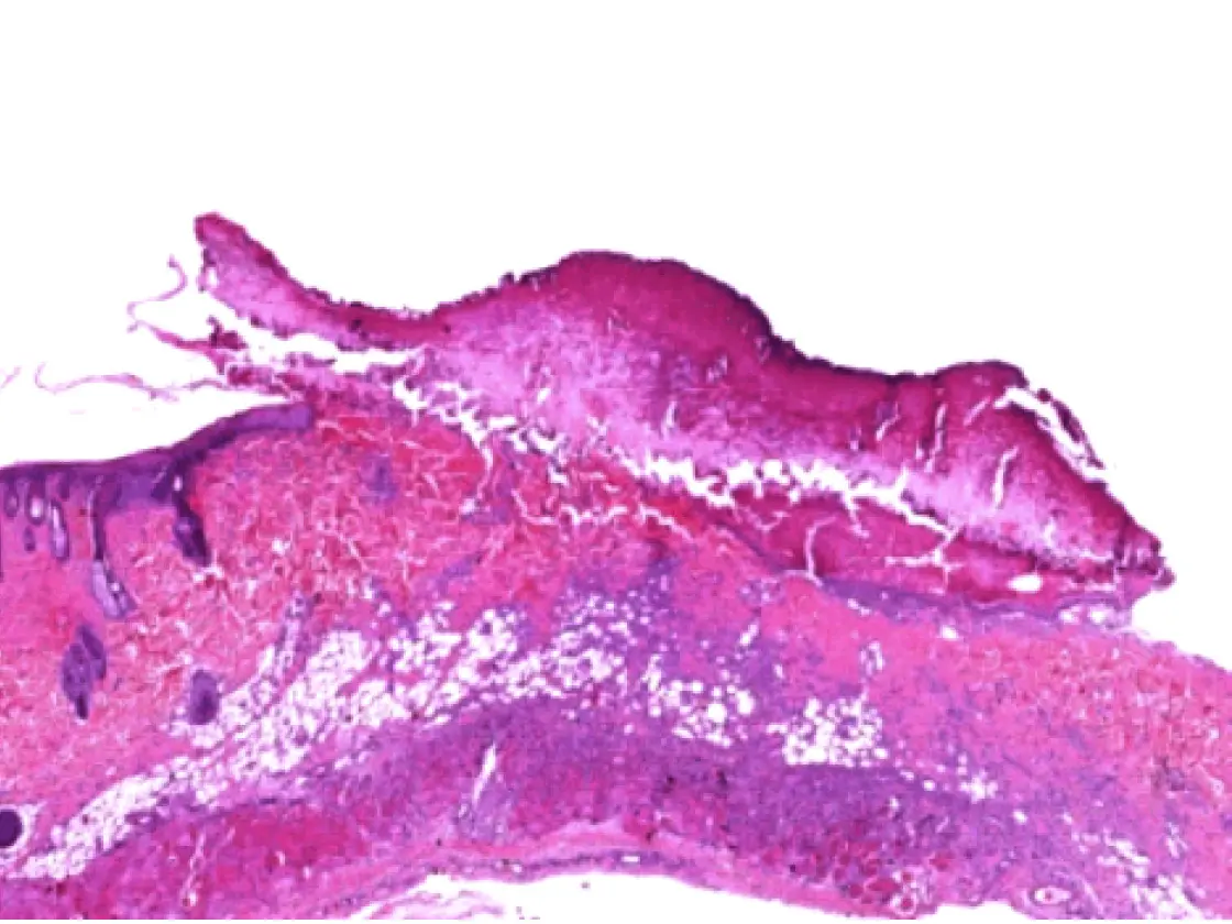 Histologischer Schnitt von Gewebe, gefärbt mit Hämatoxylin und Eosin (H&E) – Darstellung mehrerer Gewebeschichten mit unterschiedlichen Zellstrukturen und Färbungsintensitäten