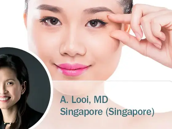 Porträt einer jungen Frau, die auf ihre Augenlider zeigt, kombiniert mit einem Bild von Dr. A. Looi aus Singapur; Hinweis auf ästhetische Lidchirurgie mit Radiofrequenz.